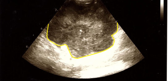 Case of Disappearing Intraperitoneal Malignant Lymphoma in a Cat (With 1 Month Prognosis and Lung Metastasis)