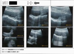 Case Report: Tumor Reduction in Canine Transitional Cell Carcinoma with the Administration of Cordyceps