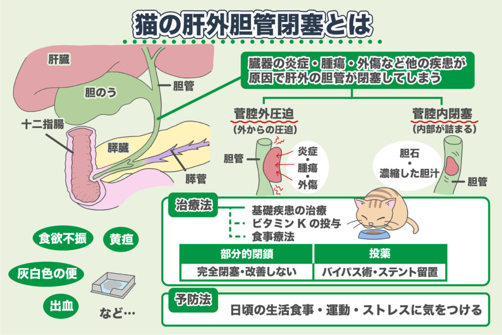 Extrahepatic Bile Duct Obstruction